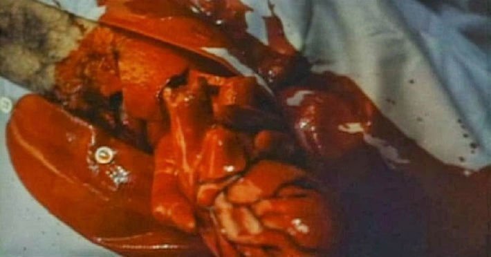 A Night to Dismember 17