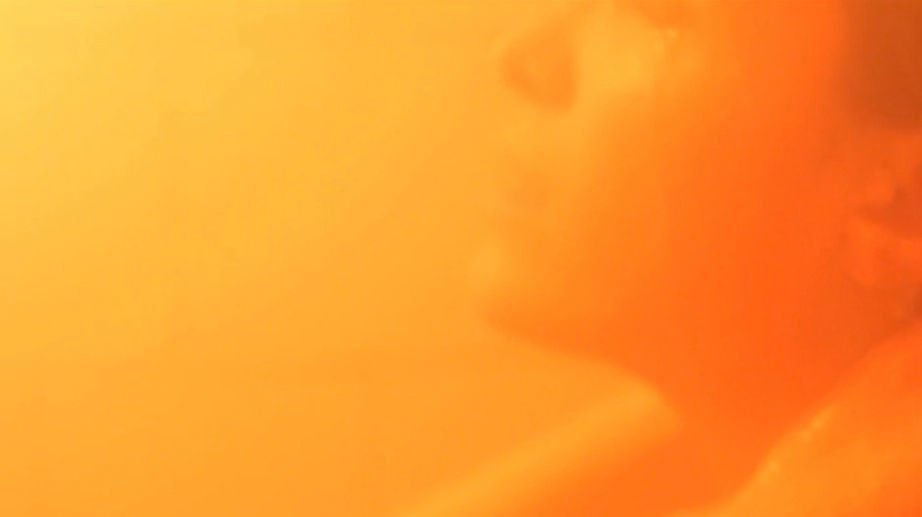 Coma 02