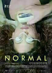 Normal