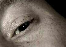 Schnupfen im Kopf 05 Schnupfen im Kopf 05