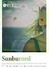 Sunburned