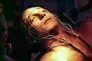 The Terminal Man 01