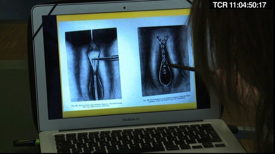 Vulva 3.0 02